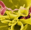 Científicos descubren el papel del tanque de estiércol en el brote de Salmonella