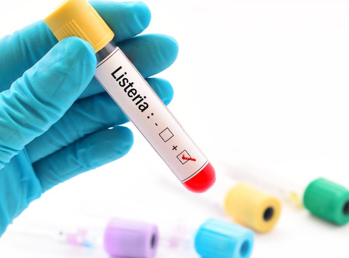 La listeria Image